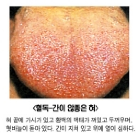 내 몸에 불필요한 독소를 제거하면 건강해진다.