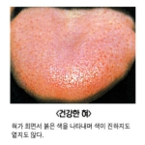 내 몸에 불필요한 독소를 제거하면 건강해진다.