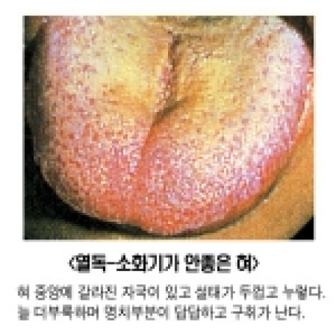 안면홍조,만성피로 이제 해독 클리닉으로 치료 하세요