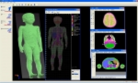 ETRI 전자파환경연구팀이 분석한 어린이 단층촬영 조합모습
