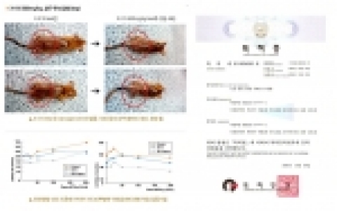 특허명 : 건선 관련 질환 치료용 조성물/ 특허권자 : 박성배 (하늘마음한의원 대표원장)