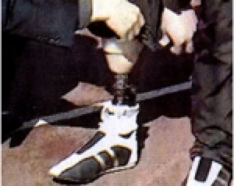 장애인 보장구에 우주공학기술 적용