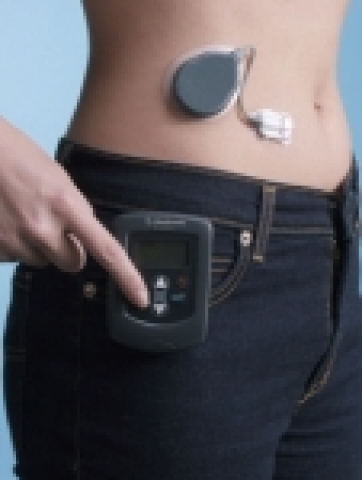 메드트로닉 연속혈당측정시스템, 가디언 RT 사진