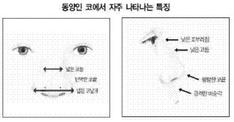 동양인 코에서 자주 나타나는 특징