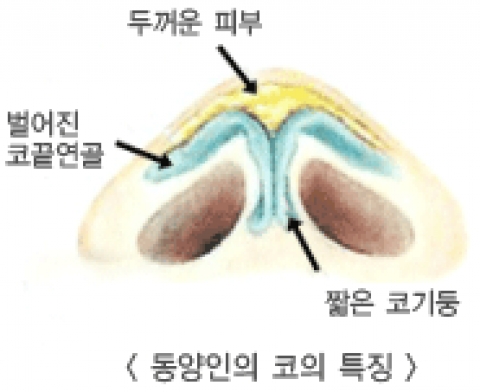 동양인 코에서 자주 나타나는 특징