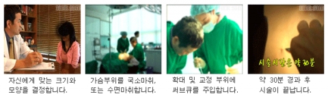 상담부터 시술까지의 과정