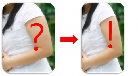 여성의 바디라인을 살려주는 ‘미니 레이저 지방용해흡입술’
