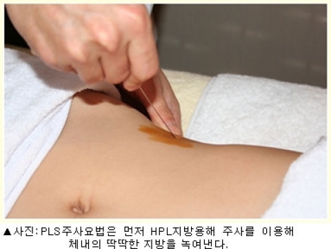 추석기간 동안 늘어난 뱃살 빠르게 줄이는 지방분해주사요법