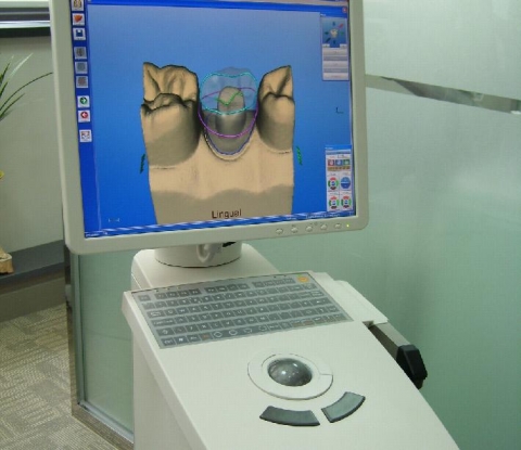 심미보철·치아미백 한 번 방문이면 OK…이스터 치과, 세렉 MCXL 로봇 시스템 도입