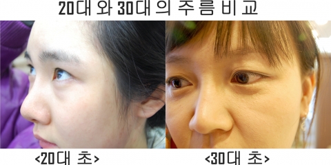 20대가 지나면 인체의 자연스러운 노화에 따라 피부 표피층이 얇아져 수분이 점차 빠지게 된다.