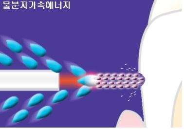 물방울레이저 1