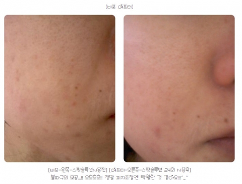 한 테스터참가 회원의 스팟솔루션(사용전)과 (사용후)
