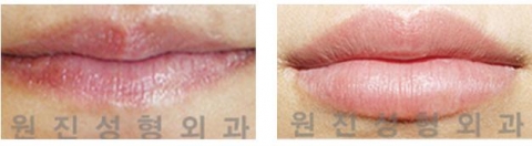 “도톰한 입술은 섹시함과 동안의 조건”
