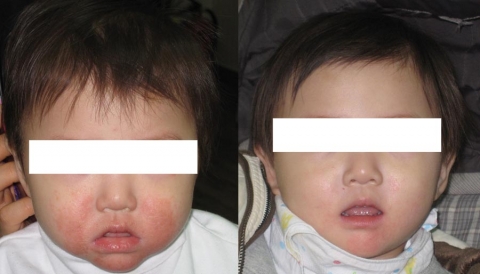 해미소 네트워크 청담점 가온경희한의원 치료 전후 비교