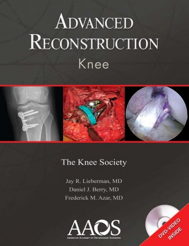 미국 정형외과학회 (American Academy of Orthopaedic Surgeons: AAOS) 에서 발간하는 최신 무릎관절재건술(Advanced Reconstructio