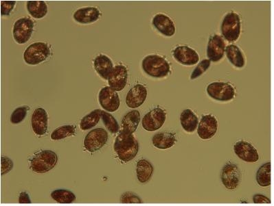 디노피시스 배양체 (세포 크기 0.05mm 내외)