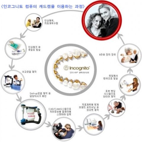 컴퓨터로 정확하고 보이지 않는 교정…인코그니토·인비절라인·투디설측교정