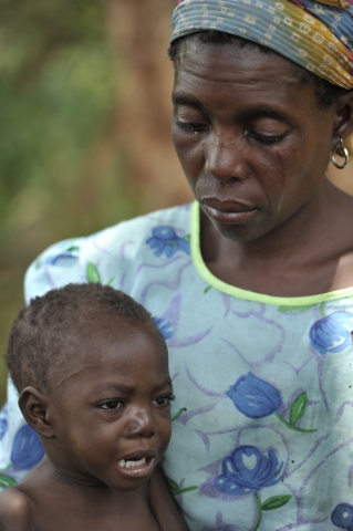 아프리카 말라위 지역의 한 아동이 말라리아 감염으로 신음하고 있다. 국제구호개발 NGO 굿네이버스는 말라리아로 고통받는 아동들을 위해 아프리카 빈곤국을 중심으로 살충모기장 보급 및 의료보건사업을 전개하고 있다. /굿네이버스 재능나눔 채우룡 작가 *바이라인 표기