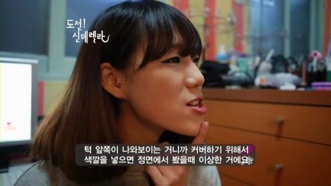 심한 주걱턱으로 밥퍼녀로 불리운 박수정씨