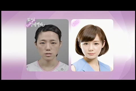 신데렐라 출연자 박수정씨 성형 수술 전 후