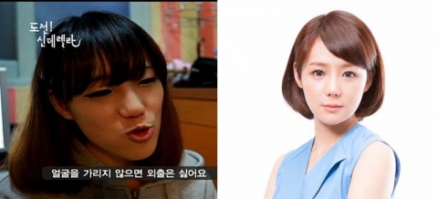 박수정씨 성형 전후