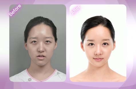 이다해 도플갱어 이세경 성형수술 전후