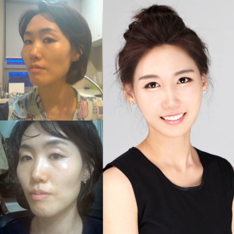 부정교합 노안굴욕녀 김채연, 이수경 도플갱어로 충격 변신해 화제를 모으고 있다,