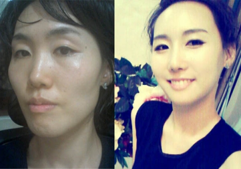 부정교합 노안굴욕녀 김채연, 이수경 도플갱어로 충격 변신해 화제다,