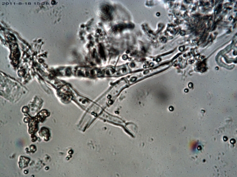 애완동물용품에 생긴 곰팡이에서 발견된 세균사진