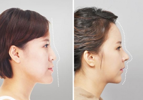 패션N 미스 에이전트에 출연한 &#039;완전평면 노안녀&#039; 원여진씨가, &#039;입체동안녀&#039;로 변신한 모습이 화제를 모으고 있다.