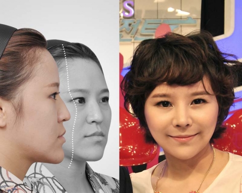 패션N 미스 에이전트에 출연한 &#039;완전평면 노안녀&#039; 원여진씨가, &#039;입체동안녀&#039;로 변신한 모습이 화제를 모으고 있다.
