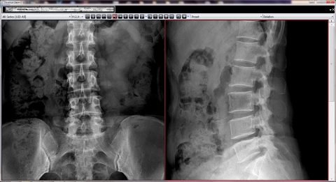 PANANOMICS Co., Ltd., developed flat panel digital X-ray detector “Wise-DR FPD”