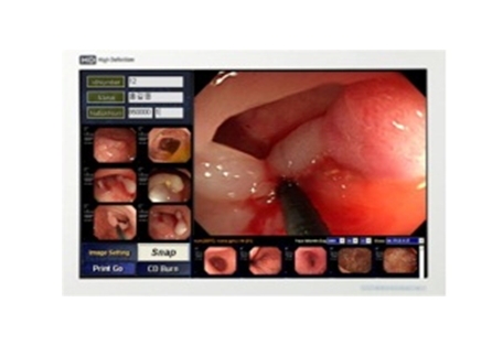 KOSTEC Co., Ltd. released 80 inches large monitor for surgical use and medical information