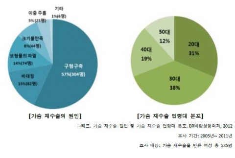 가슴확대술, 미워서 다시 한 번…재수술 환자 10명 중 6명 ‘구형구축’이 원인