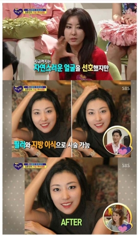 SBS ‘자기야’ 에 출연한 이태희 원장이 김완선씨의 쁘띠 가상 성형 후 동안으로 변한 모습을 소개해 눈길을 끌었다.