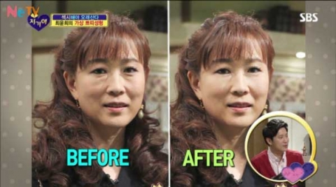 SBS ‘자기야’ 에 출연한 이태희 원장이 최윤희씨의 가상 성형 후 동안으로 변한 모습을 소개해 눈길을 끌었다.