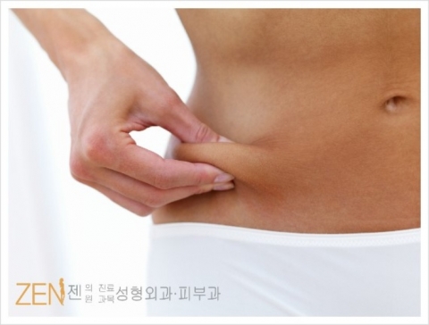 젠클리닉 지방흡입