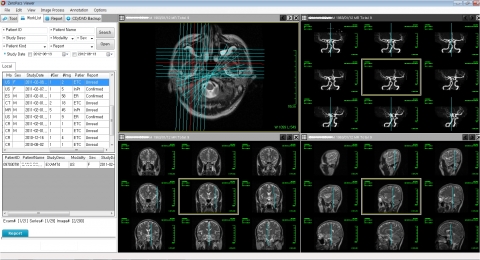 DIMEDI Attends KIMES 2013, Will Exhibit Upgraded ‘X-ray Film Scanner’