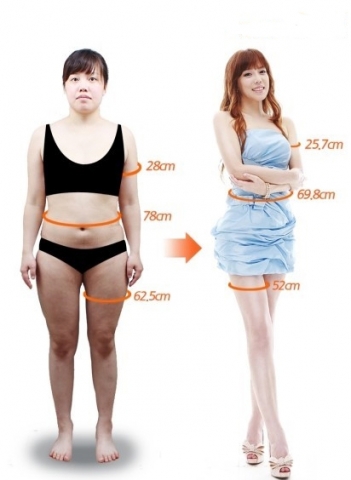 렛미인 치아부식녀 김백주가 22kg 감량에 성공한 모습.