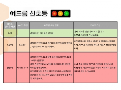 대한여드름학회가 여드름 흉터 예방지침 여드름 신호등을 제정했다.