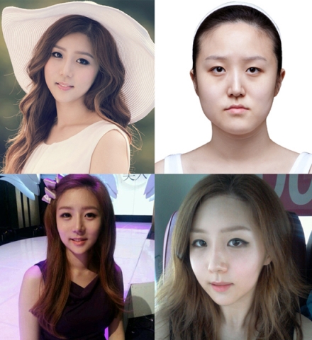 렛미인 방미선 ‘울상동생에서 베이비페이스로 변신하기까지’ 풀 스토리 공개