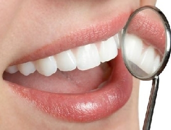 치아미백이 예비 신랑신부로부터 인기를 얻고 있다.