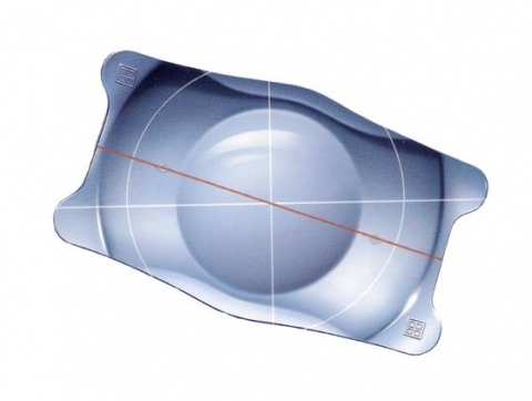 안내렌즈삽입술에 사용되는 ICL 렌즈