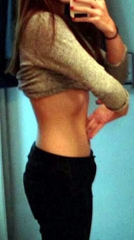 한 여성이 MPL 시술을 받은 후 자신의 모습을 카메라에 담고 있다.