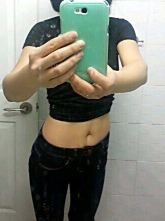 한 주부가 MPL 시술 후 40kg 감량에 성공했다.