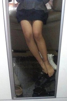 한 여성이 mpl시술 후 자신의 모습을 카메라에 담고 있다.