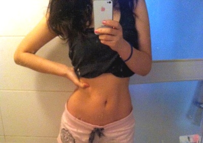 한 여성이 MPL 시술 후 자신의 모습을 담고 있다,