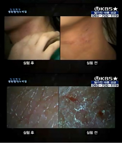 생로병사의 비밀  자연치유력편 방송 캡처