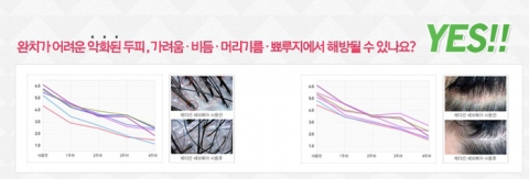 두피트러블 세보레아액의 일주일 무료 체험 이벤트가 진행 중이다.