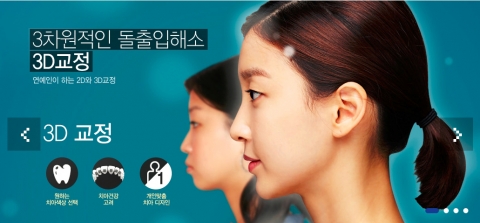 화이트치과 홈페이지 3D 치아교정 설명